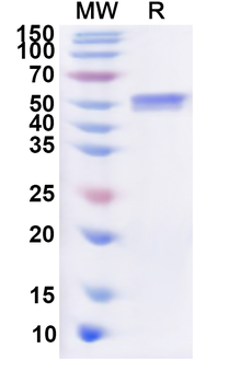 Recombinant Human ACTR1B Protein, N-His