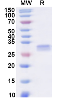 Human PTGIR Recombinant Protein (N-His-KSI)