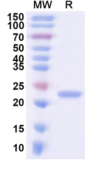 Human PTDSS1 Recombinant Protein (N-His-KSI)