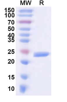 Human KCNJ5 Recombinant Protein (N-His)