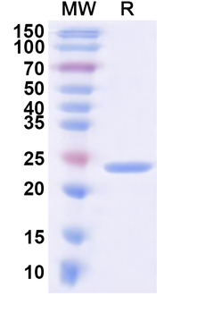 Human KCNJ6 Recombinant Protein (N-His)