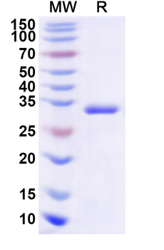 Human HNMT Recombinant Protein (N-His)
