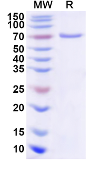 Recombinant Human EVX1 Protein, N-His-KSI