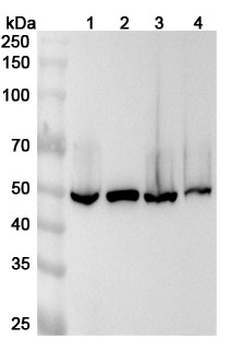 ALDH9A1 Polyclonal Antibody