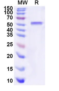 Recombinant Human HOXD13 Protein, N-His-KSI