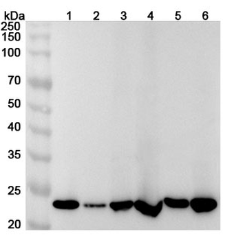 PSMB4 Polyclonal Antibody