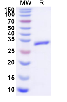 Recombinant Human CLCN6 Protein, N-His