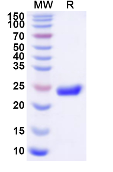 Recombinant Human CLCNKA Protein, N-His