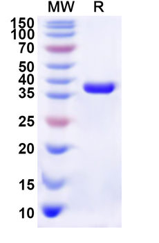 Recombinant Human CLCN2 Protein, N-His