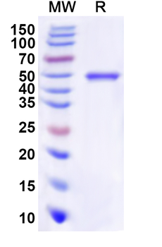 Recombinant Human TLX1 Protein, N-His-KSI