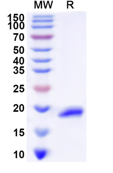 Recombinant Human LHX1 Protein, N-His