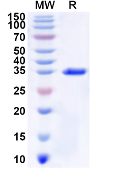 Recombinant Human SLC6A11 Protein, N-GST & C-His