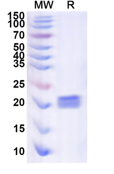 Recombinant Human EMC10 Protein, N-His