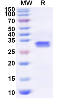 Recombinant Human RBM5 Protein, N-His