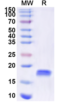Human LMO4 Recombinant Protein (N-His)