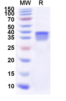 Human RPS25 Recombinant Protein (N-GST & C-His)