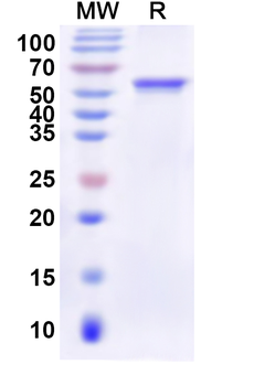 Recombinant Human AFG2A Protein, N-His
