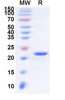 Human LTB4R Recombinant Protein (N-His-KSI)
