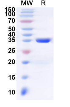 Human LCE5A Recombinant Protein (N-His-KSI)