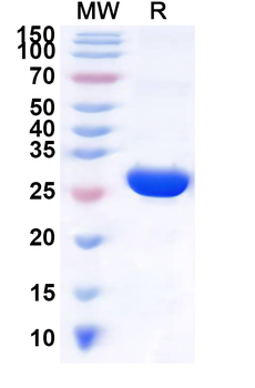 Human NKG7 Recombinant Protein (N-GST & C-His)