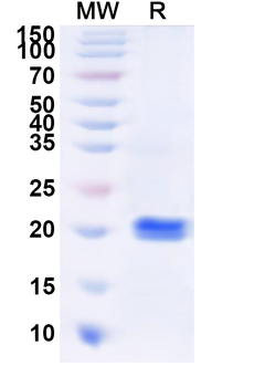 Recombinant Human KRT39 Protein, N-His
