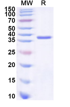 Recombinant Human TGFBR3 Protein, N-His