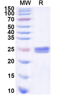 Human SRSF11 Recombinant Protein (N-His)