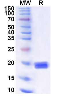 Recombinant Human HIC1 Protein, N-His