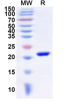 Recombinant Human JOSD1 Protein, N-His