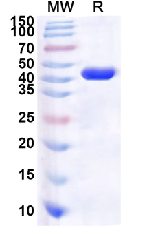 Human SYCP1 Recombinant Protein (N-His)