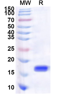 Human NAB2 Recombinant Protein (N-His)