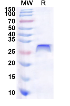 Human ZKSCAN8 Recombinant Protein (N-His)