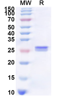 Human SLC15A2 Recombinant Protein (N-His)