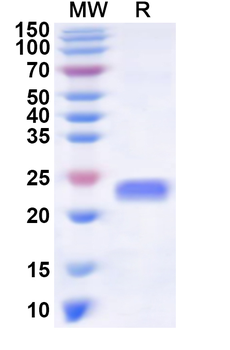 Human ZSCAN23 Recombinant Protein (N-His)