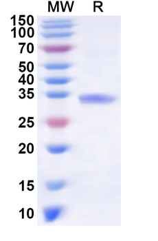 Human TNFAIP1 Recombinant Protein (N-His)