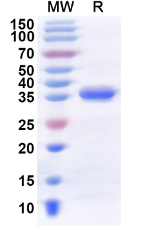 Human KMT5B Recombinant Protein (N-His)