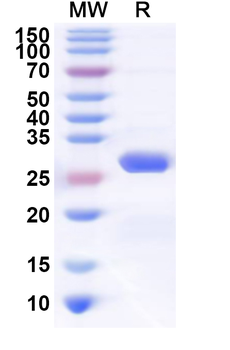 Human TJAP1 Recombinant Protein (N-His)