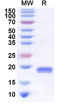 Recombinant Human LDLRAP1 Protein, N-His