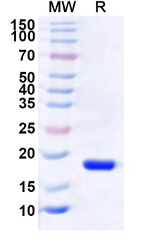 Human BRMS1L Recombinant Protein (N-His)