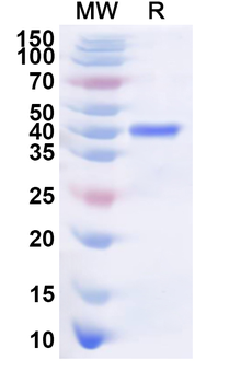Recombinant Human DCAF8 Protein, N-His