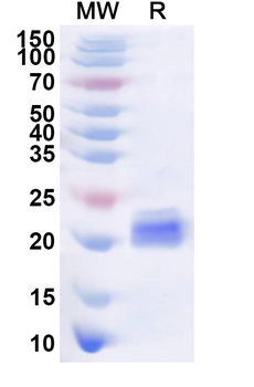 Recombinant Human GFI1B Protein, N-His
