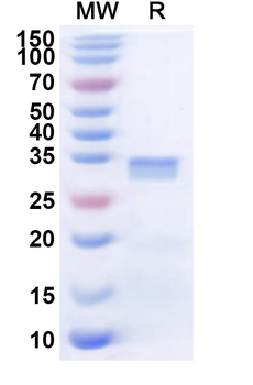 Human CDC42BPG Recombinant Protein (N-His)