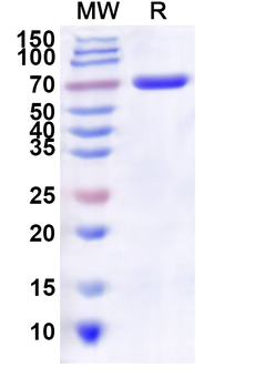 Recombinant Human ATP11A Protein, N-His