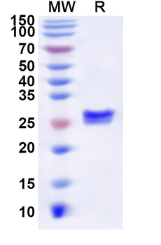 Human HNRNPF Recombinant Protein (N-His)