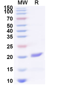 Recombinant Human CD300LF Protein, N-His