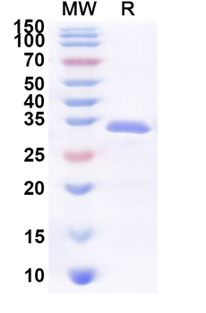 Recombinant Human TANGO2 Protein, N-His