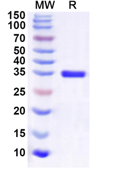 Recombinant Human CKS1B Protein, N-GST & C-His