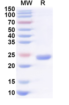 Recombinant Human DLG1 Protein, N-His