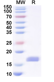 Recombinant Human LCP2 Protein, N-His