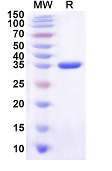 Human ZDHHC24 Recombinant Protein (N-GST & C-His)